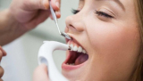 Профессиональная гигиена полости рта (за 1 зуб)